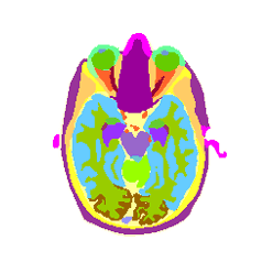 head slice 077