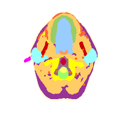 head slice 122